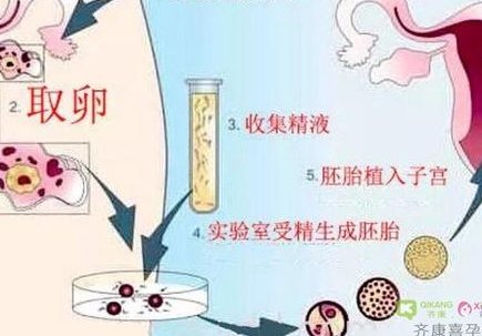 长沙第三代试管婴儿怀孕生孩子总费用大概是多少钱？