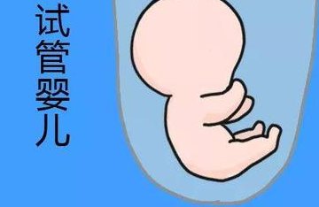 赴日试管婴儿费用全揭秘，如何省钱的实用攻略