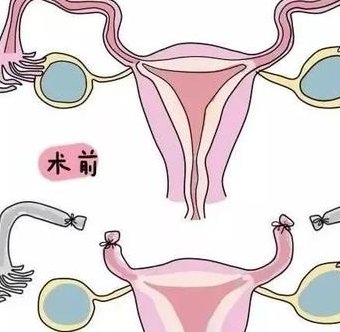 公布！广东省中山市最诚信的助孕公司是哪家？排名第一的是它