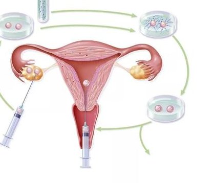 广东省东莞市广济医院VS康华医院，哪家试管婴儿服务更胜一筹？